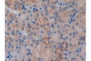 Detection of IL17RA in Mouse Kidney Tissue using Polyclonal Antibody to Interleukin 17 Receptor A (IL17RA)
