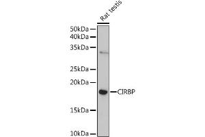 Western blot analysis of extracts of Rat testis, using CIRBP Rabbit pAb (ABIN6129747, ABIN6138627, ABIN6138629 and ABIN6221699) at 1:1000 dilution. (CIRBP Antikörper  (AA 1-172))