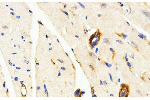 Immunohistochemistry of paraffin-embedded Mouse heart using LAMP3 Polyclonal Antibody at dilution of 1:200 (40x lens).