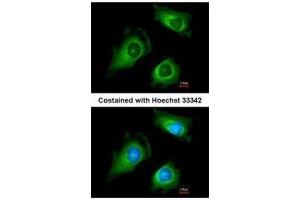 ICC/IF Image Immunofluorescence analysis of methanol-fixed HeLa, using Fukutin, antibody at 1:200 dilution. (Fukutin Antikörper)