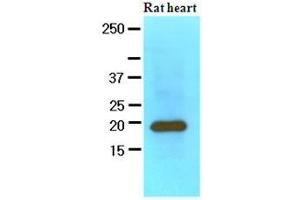 The extracts of Rat heart (60 ug) were resolved by SDS-PAGE, transferred to nitrocellulose membrane and probed with anti-human MYL2 (1:1000).