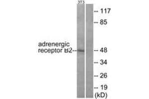 Western Blotting (WB) image for anti-Adrenergic, beta-2-, Receptor, Surface (ADRB2) (AA 321-370) antibody (ABIN2888906) (beta 2 Adrenergic Receptor Antikörper  (AA 321-370))
