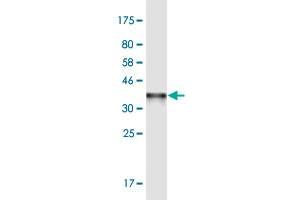 Western Blot detection against Immunogen (37. (SHMT2 Antikörper  (AA 401-503))