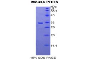 SDS-PAGE analysis of Mouse PDHb Protein. (PDHB Protein)