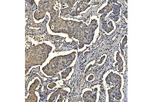 IHC analysis of Aldolase/ALDOA using anti-Aldolase/ALDOA antibody (ABIN7601908). (ALDOA Antikörper  (AA 50-364))