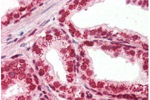 Human Prostate (formalin-fixed, paraffin-embedded) stained with APEX1 antibody ABIN396973 at 1:250 followed by biotinylated goat anti-rabbit IgG secondary antibody ABIN481713, alkaline phosphatase-streptavidin and chromogen. (APEX1 Antikörper)