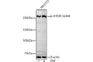 Western blot analysis of extracts of NIH/3T3 cells, using Phospho-mTOR-S2448 antibody (ABIN7268435) at 1:1000 dilution. (MTOR Antikörper  (pSer2448))