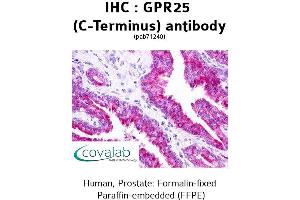 Image no. 2 for anti-G Protein-Coupled Receptor 25 (GPR25) (C-Term) antibody (ABIN1735034)