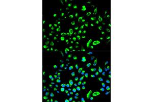 Immunofluorescence analysis of HeLa cells using YWHAQ antibody. (14-3-3 theta Antikörper)