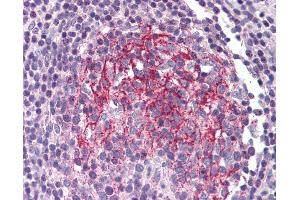 Anti-IL1R2 antibody IHC of human small intestine, Peyer's patch. (IL1R2 Antikörper)