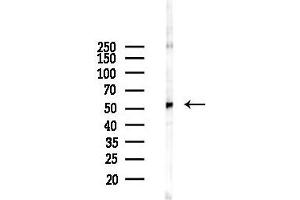Western blot analysis of lysates from HUVEC cells(starvation 24h treatment), using CCN Antibody at 1/1000 dilution.
