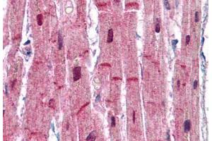 Human Heart: Formalin-Fixed, Paraffin-Embedded (FFPE) (ACTN2 Antikörper  (AA 215-500))
