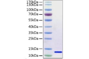 SARS-CoV-2 Envelope (SARS-CoV-2 E) (AA 1-75) (Active) protein (His-Avi Tag)