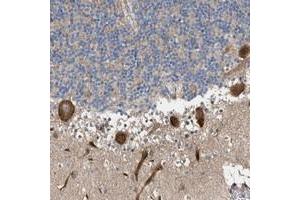 Immunohistochemical staining of human cerebellum with MFSD6 polyclonal antibody  shows strong cytoplasmic positivity in Purkinje cells.