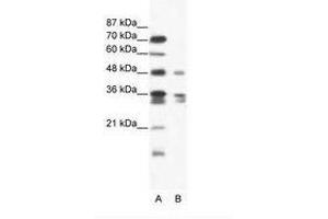 Image no. 1 for anti-Zinc Finger Protein 577 (ZNF577) (AA 373-422) antibody (ABIN202626) (ZNF577 Antikörper  (AA 373-422))