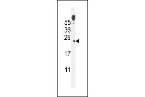 VOPP1 Antikörper  (AA 65-95)