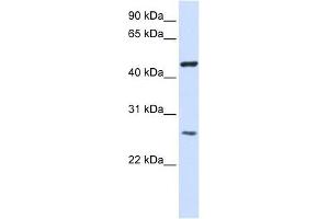 TMEM127 antibody used at 1 ug/ml to detect target protein.