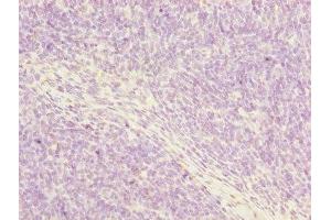 Immunohistochemistry of paraffin-embedded human thymus tissue using ABIN7162915 at dilution of 1:100 (Periostin Antikörper  (AA 24-836))