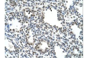 NKD1 antibody was used for immunohistochemistry at a concentration of 4-8 ug/ml.