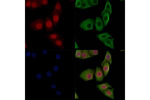 ABIN7093236 and ABIN7097248 staining Hela cells(heat shock treatment) by IF/ICC.