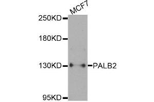 Western blot analysis of extracts of MCF7 cells, using PALB2 antibody. (PALB2 Antikörper)