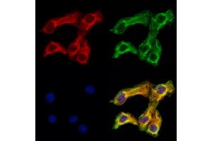 ABIN6261040 and ABIN6273217 staining Hela cells by IF/ICC.