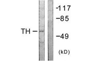 Western Blotting (WB) image for anti-Tyrosine Hydroxylase (TH) (AA 5-54) antibody (ABIN2888712) (Tyrosine Hydroxylase Antikörper  (AA 5-54))