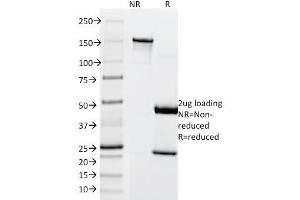 SDS-PAGE Analysis Purified MITF Mouse Monoclonal Antibody (SPM290). (MITF Antikörper)