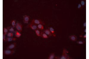 ABIN6276414 staining HeLa cells by ICC/IF. (ERBB3 Antikörper  (C-Term))