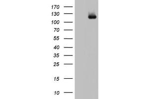 Western Blotting (WB) image for anti-ADAM Metallopeptidase with Thrombospondin Type 1 Motif, 1 (ADAMTS1) (AA 412-644) antibody (ABIN2715714) (ADAMTS1 Antikörper  (AA 412-644))