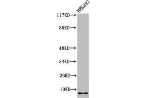 Western Blot analysis of 293 cells using Cleaved-Integrin α5 LC (E895) Polyclonal Antibody (ITGA5 Antikörper  (Cleaved-Glu895))