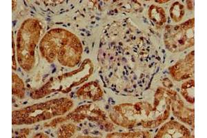Immunohistochemistry (IHC) image for anti-Phosphoinositide 3-kinase Regulatory Subunit 4 (PIK3R4) (AA 1300-1358), (Regulatory Subunit 4) antibody (ABIN7163291)