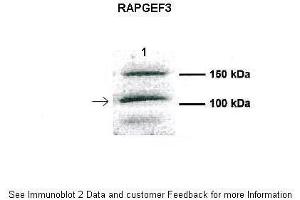 Human CFBE (RAPGEF3 Antikörper  (Middle Region))