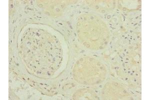 Immunohistochemistry of paraffin-embedded human kidney tissue using ABIN7142279 at dilution of 1:100 (MRPS6 Antikörper  (AA 1-125))