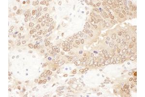 Immunohistochemistry (IHC) image for anti-Acetyl-CoA Acetyltransferase 2 (ACAT2) (AA 150-200) antibody (ABIN7454576)