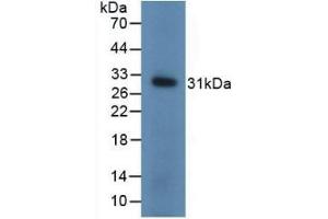 Detection of Recombinant UCHL1, Mouse using Polyclonal Antibody to Ubiquitin Carboxyl Terminal Hydrolase L1 (UCHL1) (UCHL1 Antikörper  (AA 2-223))