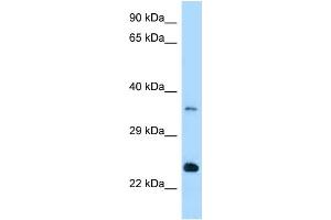 WB Suggested Anti-Rab13 Antibody Titration: 1. (RAB13 Antikörper  (Middle Region))