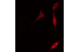 ABIN6266510 staining A549 cells by IF/ICC. (Claudin 5 Antikörper  (C-Term))