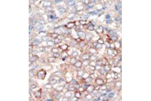 Image no. 2 for anti-Phosphoinositide 3-kinase Regulatory Subunit 4 (PIK3R4) (N-Term) antibody (ABIN360462) (PIK3R4 Antikörper  (N-Term))