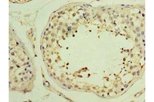 Immunohistochemistry of paraffin-embedded human testis tissue using ABIN7174000 at dilution of 1:100