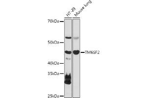 Western blot analysis of extracts of various cell lines, using TM6SF2 antibody (ABIN7270937) at 1:1000 dilution. (TM6SF2 Antikörper)