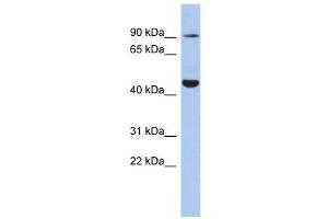 KCNH2 antibody used at 1 ug/ml to detect target protein. (KCNH2 Antikörper)
