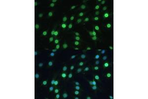 Immunofluorescence analysis of C6 cells using LBR Polyclonal Antibody (ABIN6128194, ABIN6143105, ABIN6143106 and ABIN6221130) at dilution of 1:100 (40x lens).