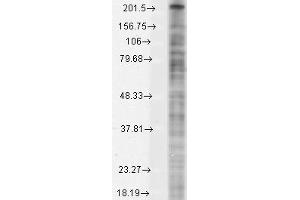 Western Blotting (WB) image for anti-Sodium Channel, Voltage-Gated, Type X, alpha Subunit (SCN10A) (C-Term) antibody (ABIN6658124)