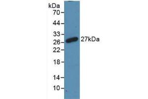 Western blot analysis of recombinant Rat RANk. (TNFRSF11A Antikörper  (AA 31-214))