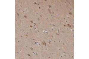 Immunohistochemical staining (Formalin-fixed paraffin-embedded sections) of human cerebral cortex with SCRN1 polyclonal antibody  shows moderate cytoplasmic positivity in neuronal cells. (Secernin 1 Antikörper)