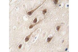 IHC analysis of FFPE human brain tissue stained with RUNX1 antibody (RUNX1 Antikörper  (AA 227-255))