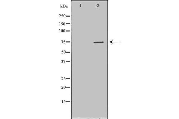 CPT2 Antikörper  (Internal Region)