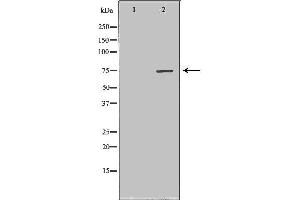 Western blot analysis of extracts of Mouse fetal kidney tissue lysate, using CPT2 antibody. (CPT2 Antikörper  (Internal Region))