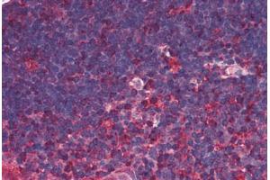 Human Thymus (formalin-fixed, paraffin-embedded) stained with TRDMT1 antibody ABIN290198 at 5 ug/ml followed by biotinylated anti-mouse IgG secondary antibody ABIN481714, alkaline phosphatase-streptavidin and chromogen. (Dnmt2 Antikörper)